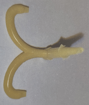 注塑產(chǎn)品缺陷料頭附近有暗區(qū)的理解 注塑產(chǎn)品缺陷料頭附近有暗區(qū)的理解